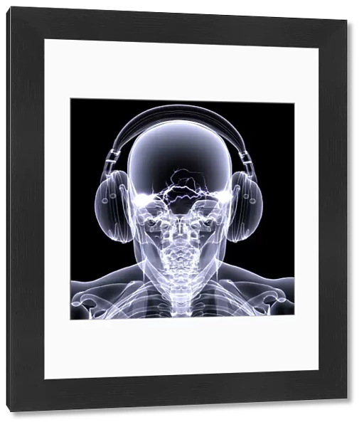 Skeleton X-Ray - DJ 3