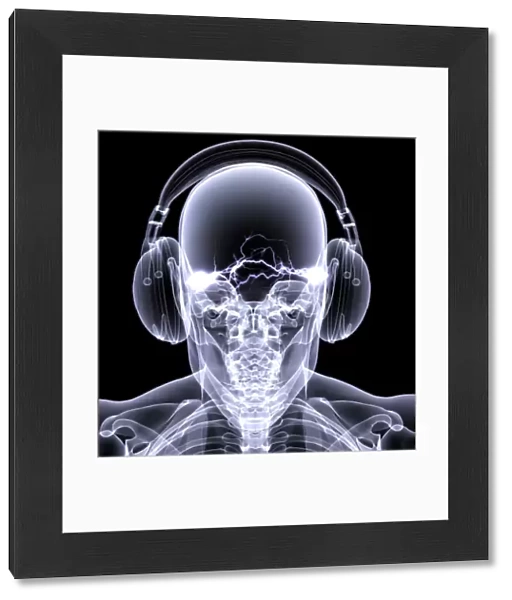 Skeleton X-Ray - DJ 3